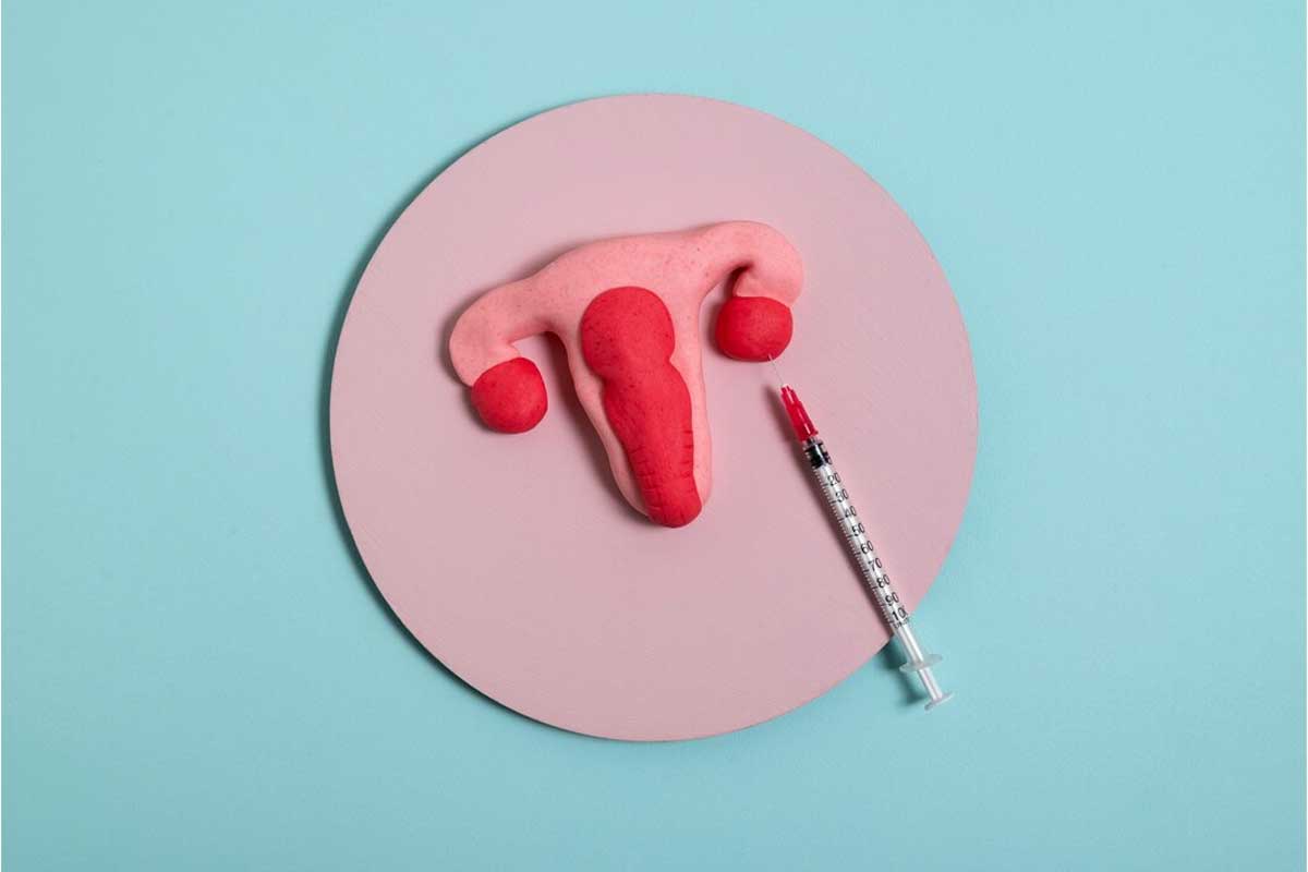 Vaginal Infection (Vaginitis)